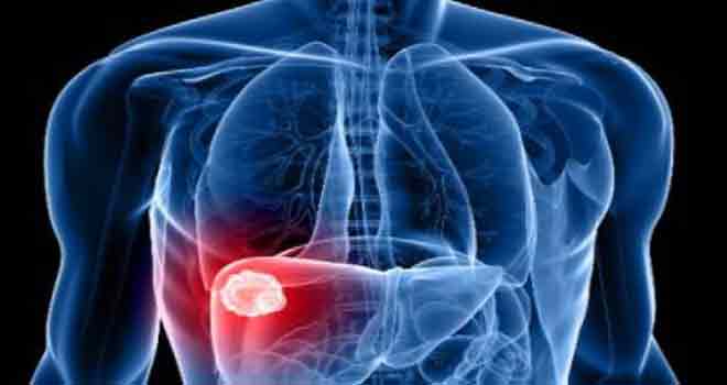 L’OMS appelle à une riposte mondiale urgente contre l&rsquo;hépatite virale