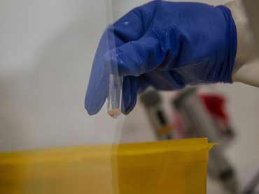 RDC : l&rsquo;OMS déclare la fin de la dernière épidémie d&rsquo;Ébola dans le pays